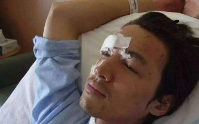 娱乐圈没整过容的明星_华晨宇整容_刘恺威整容后遗症